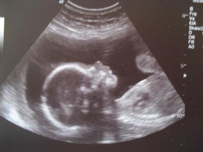 Bild zu Babybildchen - Forum für Februar - Mamis