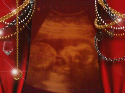 Bild zu Aktuelles Ultraschallbild von unserem Liebling - Forum für Februar - Mamis