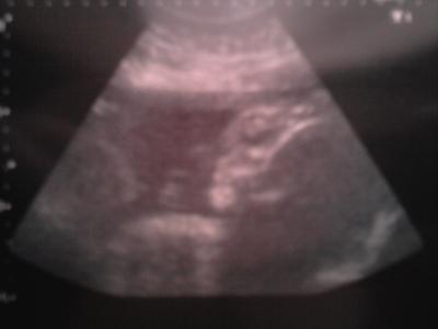 Bild zu heute fa termin gehabt und bild bekommen!!! - Forum für Februar - Mamis