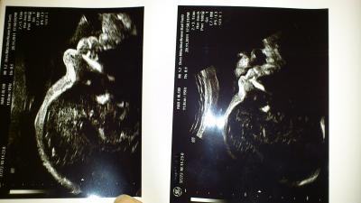 Bild zu Außerplanmäßig beim FA.... - Forum für Februar - Mamis