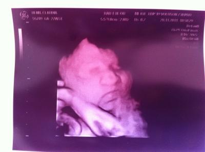 Bild zu Endlich auch 3D - Forum für Februar - Mamis