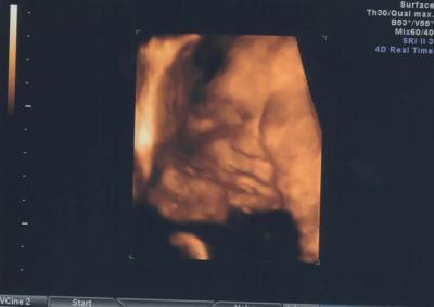 Bild zu Möchte euch meine Maus vorstellen.. - Forum für Februar - Mamis