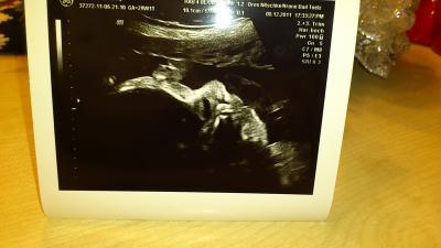 Bild zu Zurück vom FA! - Forum für Februar - Mamis