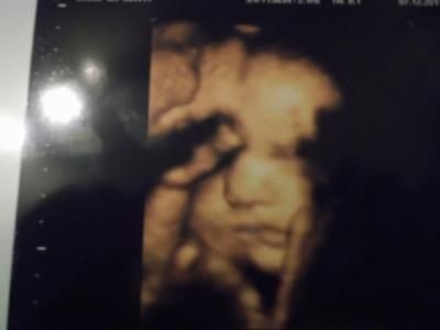 Bild zu Unser kleiner gestern - Forum für Februar - Mamis