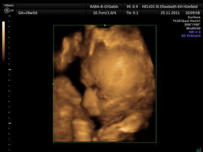 Bild zu So jetzt sind die letzten Sachen fürs Baby bestellt....... - Forum für Februar - Mamis