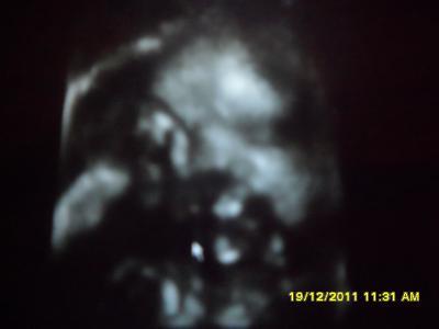 Bild zu Wieder zu Hause.... und vorsichtiges aufatmen.... (vorsicht LAAAAANG) - Forum für Februar - Mamis