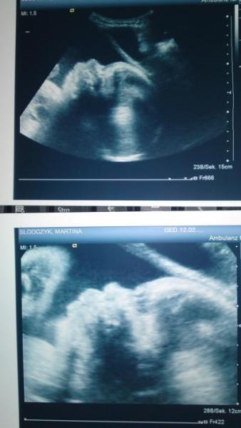 Bild zu 3. Screening Teil 1 und Geburtsmodusgespräch - Forum für Februar - Mamis