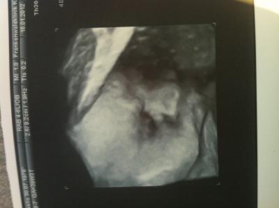 Bild zu zurück vom Geburtsplanungsgespräch - Forum für Februar - Mamis