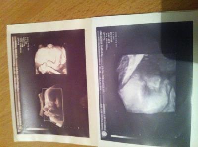 Bild zu 4D-US Bilder - Forum für Februar - Mamis