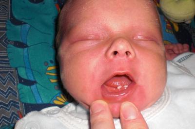 Bild zu Bild von Joshuas Hexenzähnchen - Forum für Februar - Mamis