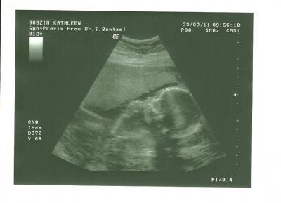 Bild zu zum Beitrag unten ---Daumenlutschen--- - Forum für Februar - Mamis