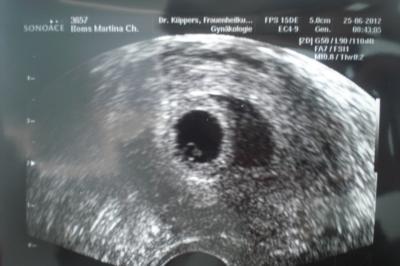 Bild zu Hatte heute Termin beim Gyn. - Forum für Februar - Mamis