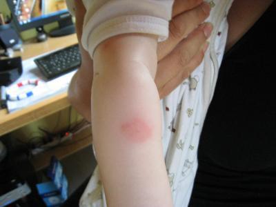 Bild zu @wunderkind noch was anderes - Forum für Februar - Mamis