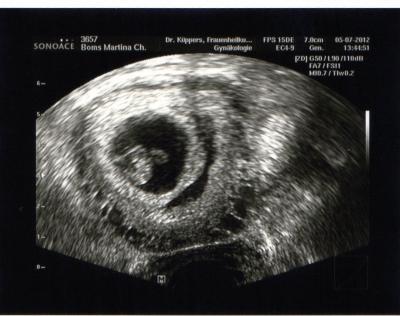 Bild zu Komme vom FA - Forum für Februar - Mamis