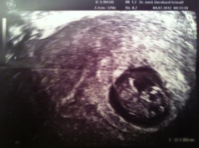 Bild zu so was schönes! - Forum für Februar - Mamis