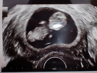 Bild zu zuruck vom FA - Forum für Februar - Mamis