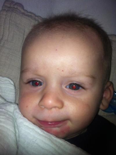 Bild zu Noch jemand ohne Haare hier? - Forum für Februar - Mamis