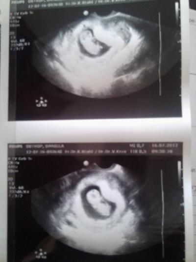 Bild zu Ich bin soooooooooooooo erleichtert!!!!!!!!!!!!!!! - Forum für Februar - Mamis