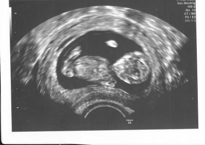 Bild zu Neuigkeiten - Forum für Februar - Mamis