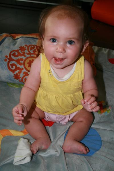 Bild zu Schorf und Haarwachstum, zusammenhang? - Forum für Februar - Mamis