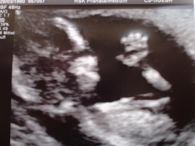 Bild zu zurück !!! - Forum für Februar - Mamis