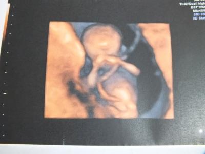 Bild zu Wieder da!!! - Forum für Februar - Mamis