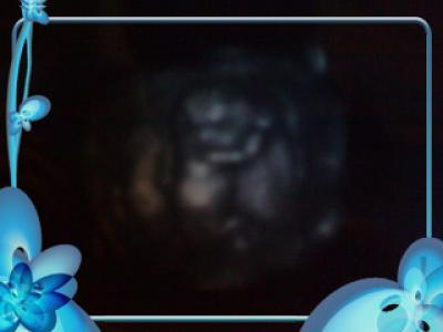 Bild zu Bericht nach FA - Forum für Februar - Mamis
