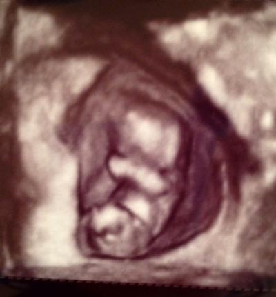 Bild zu Endlich Internet und kann auch Fotos zeigen! :) - Forum für Februar - Mamis