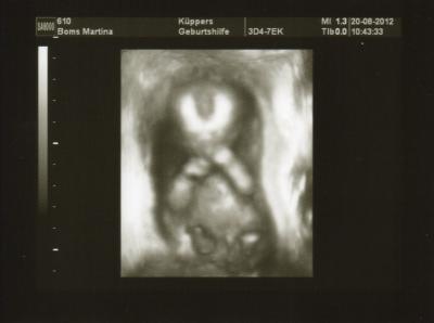 Bild zu Komme vom FA - Forum für Februar - Mamis