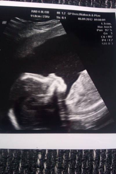 Bild zu wieder da vom FA... und wir haben ein Outing :) - Forum für Februar - Mamis