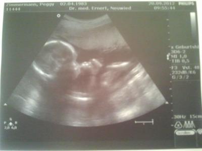 Bild zu Wieder zurück uuuuuuuund Outing ;-) - Forum für Februar - Mamis