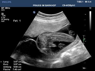 Bild zu Meine Zwillinge und Bauchfotos - Forum für Februar - Mamis