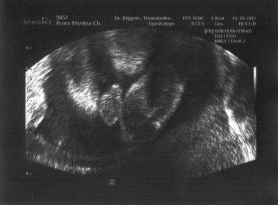 Bild zu Hatte heute Termin beim Doc - Forum für Februar - Mamis