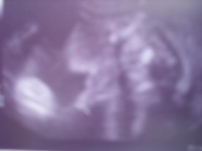 Bild zu Zurück vom Zuckertest und US... - Forum für Februar - Mamis