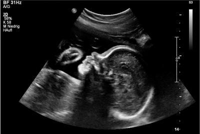 Bild zu Zurück von der FD und Organscreening!!! - Forum für Februar - Mamis