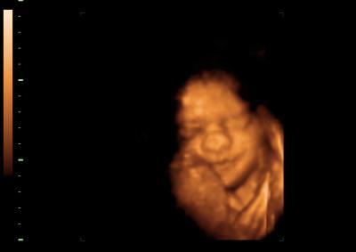 Bild zu 3D hat geklappt *freu* sooooo happy :) sooo süß :) + heute 30SSW - Forum für Februar - Mamis
