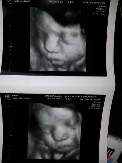 Bild zu sehen alle baby gleich aus :D - Forum für Februar - Mamis
