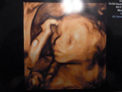 Bild zu zu" sehen alle babys gleich aus" hier mein Bildchen in 3 D - Forum für Februar - Mamis