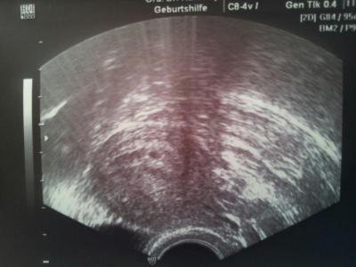 Bild zu komme grad vom FA! - Forum für Februar - Mamis