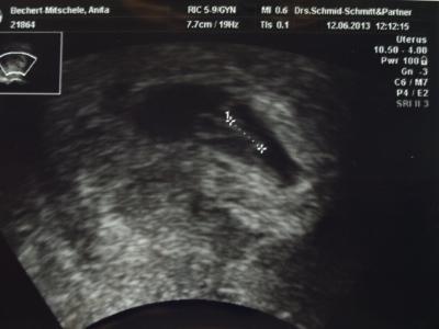 Bild zu Zurück vom FA - Forum für Februar - Mamis