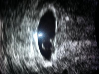Bild zu Bericht FA - Forum für Februar - Mamis