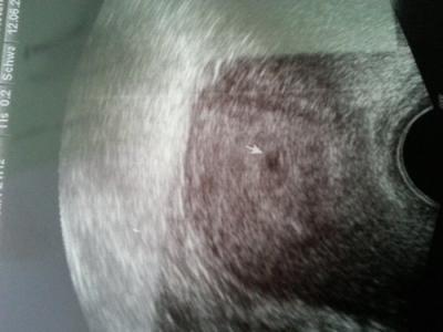 Bild zu Erstes Ultraschallbild - Forum für Februar - Mamis