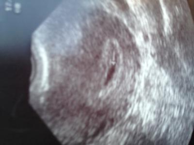 Bild zu us bild - Forum für Februar - Mamis