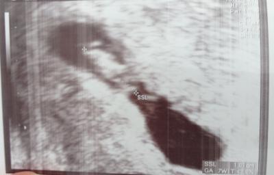 Bild zu Alles gut... - Forum für Februar - Mamis