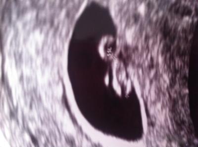 Bild zu Zurück vom FA - Forum für Februar - Mamis