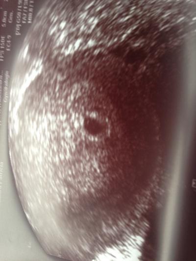 Bild zu Zurück vom Frauenarzt - Forum für Februar - Mamis