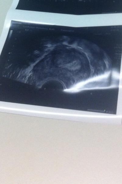 Bild zu Brauche mal eure Meinung :( - Forum für Februar - Mamis