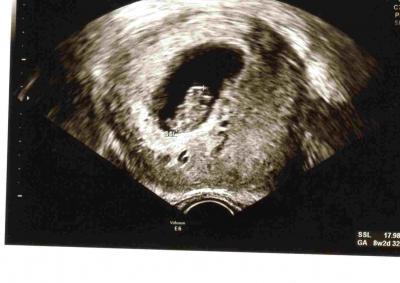 Bild zu oh happy day - Forum für Februar - Mamis