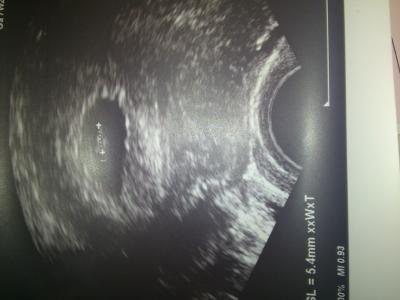 Bild zu zurück vom FÄ... :) - Forum für Februar - Mamis