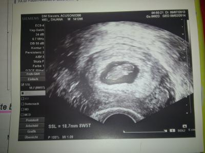 Bild zu zurück vom FÄ... :) - Forum für Februar - Mamis